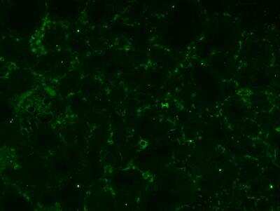 Immunohistochemistry-Paraffin: VCAM-1/CD106 Antibody (1.G11B1) [NBP1-28404]