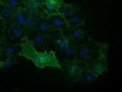 Immunocytochemistry/ Immunofluorescence: VCAM-1/CD106 Antibody (OTI3H10) [NBP2-03600]