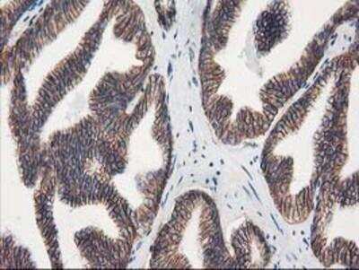 Immunohistochemistry-Paraffin: VCAM-1/CD106 Antibody (OTI3H10) [NBP2-03600]