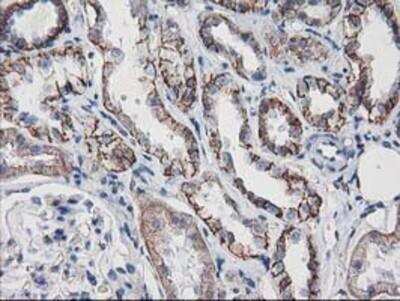Immunohistochemistry-Paraffin: VCAM-1/CD106 Antibody (OTI3H10) [NBP2-03600]