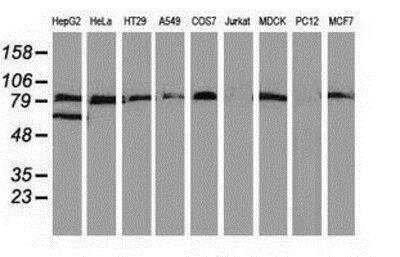 Western Blot: VCAM-1/CD106 Antibody (OTI3H10) [NBP2-03600]