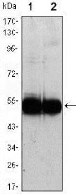 Western Blot: VCAM-1/CD106 Antibody (6G9)Azide and BSA Free [NBP2-81005]