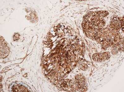 Immunohistochemistry: VCAM-1/CD106 Antibody (6G9) - BSA Free [NBP1-47491]