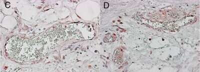Immunohistochemistry: VCAM-1/CD106 Antibody (6G9) - BSA Free [NBP1-47491]