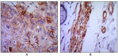 Immunohistochemistry-Paraffin: VCAM-1/CD106 Antibody (6G9) - BSA Free [NBP1-47491]