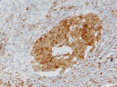 Immunohistochemistry-Paraffin: VCAM-1/CD106 Antibody (6G9) - BSA Free [NBP1-47491]