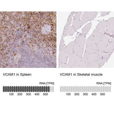 Immunohistochemistry-Paraffin: VCAM-1/CD106 Antibody [NBP2-38223]