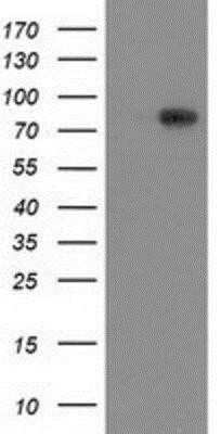 Western Blot: VCAM-1/CD106 Antibody (OTI3H10)Azide and BSA Free [NBP2-74840]