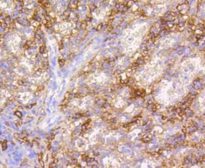 Immunohistochemistry-Paraffin: VCAM-1/CD106 Antibody (SA05-04) [NBP2-67292]