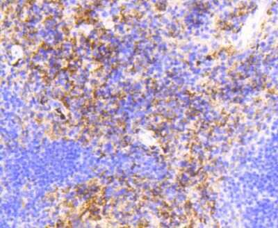 Immunohistochemistry-Paraffin: VCAM-1/CD106 Antibody (SA05-04) [NBP2-67292]