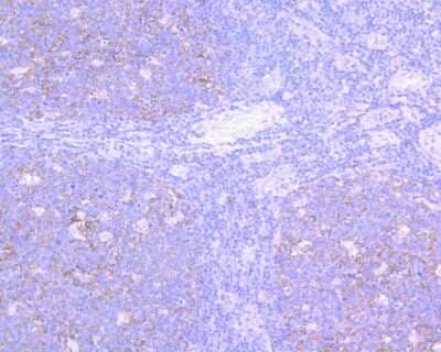 Immunohistochemistry-Paraffin: VCAM-1/CD106 Antibody (SA05-04) [NBP2-67292]