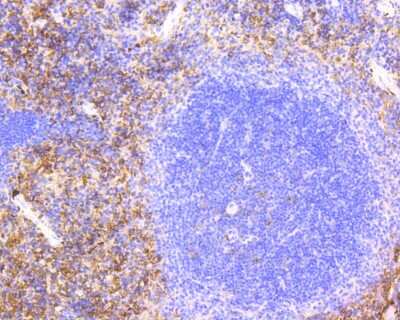 Immunohistochemistry-Paraffin: VCAM-1/CD106 Antibody (SA05-04) [NBP2-67292]