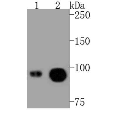 Western Blot: VCAM-1/CD106 Antibody (SA05-04) [NBP2-67292]