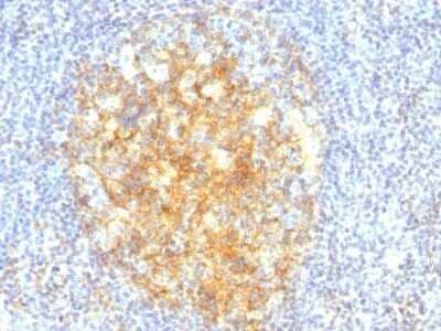 Immunohistochemistry-Paraffin: VCAM-1/CD106 Antibody (VCAM1/843) - IHC-Prediluted [NBP2-48172]