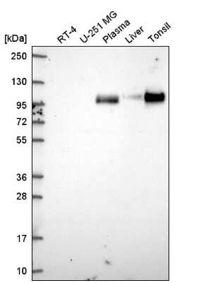 Western Blot: VCAM-1/CD106 Antibody [NBP2-55858]