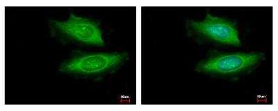 Immunocytochemistry/ Immunofluorescence: VCIP135/VCPIP1 Antibody [NBP1-32663]