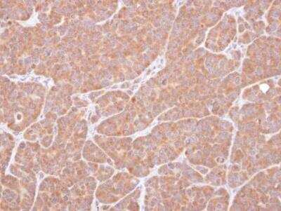 Immunohistochemistry-Paraffin: VCIP135/VCPIP1 Antibody [NBP1-32663]