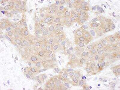 Immunohistochemistry-Paraffin: VCIP135/VCPIP1 Antibody [NBP1-49939]