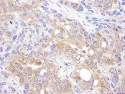 Immunohistochemistry-Paraffin: VCIP135/VCPIP1 Antibody [NBP1-49939]