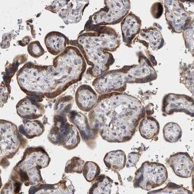 Immunohistochemistry-Paraffin: VCIP135/VCPIP1 Antibody [NBP2-13515]