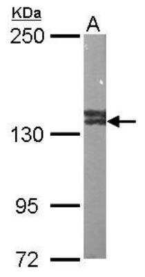 Western Blot: VCIP135/VCPIP1 Antibody [NBP1-32663]