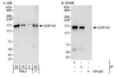 Western Blot: VCIP135/VCPIP1 Antibody [NBP1-49939]