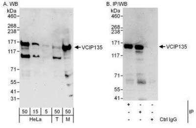 Western Blot: VCIP135/VCPIP1 Antibody [NBP1-49940]