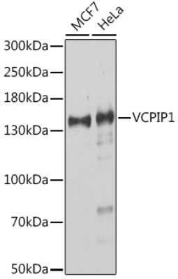 Western Blot: VCIP135/VCPIP1 AntibodyAzide and BSA Free [NBP2-94222]