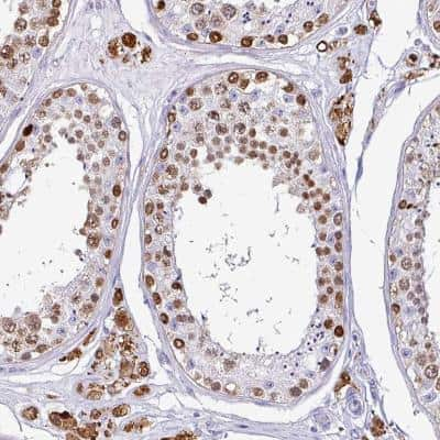 Immunohistochemistry: VCY Antibody [NBP2-46707]