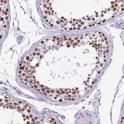 Immunohistochemistry: VCX Antibody [NBP2-46770]