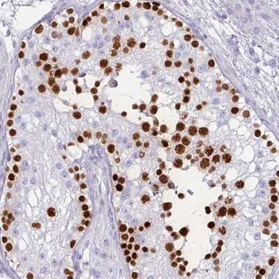 Immunohistochemistry-Paraffin: VCX2 Antibody [NBP2-33426]