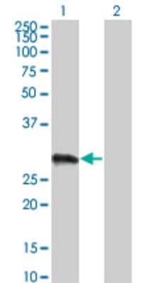 Western Blot: VCX3A Antibody (6A3) [H00051481-M01]