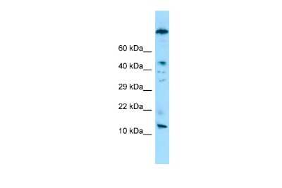 Western Blot: VCY Antibody [NBP2-83748]