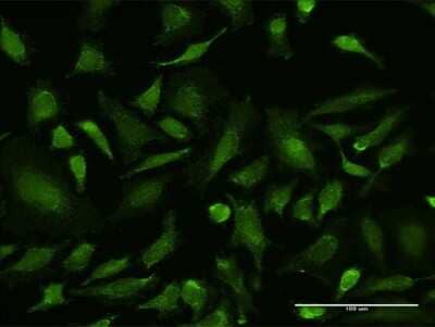 Immunocytochemistry/ Immunofluorescence: VDAC1 Antibody (2E10) [H00007416-M17]