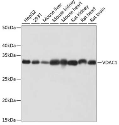 Western Blot: VDAC1 Antibody (6B1K1) [NBP3-15871]