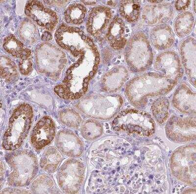 Immunohistochemistry-Paraffin: VDAC1 Antibody [NBP2-38163]