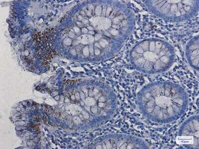 Immunohistochemistry-Paraffin: VDAC1 Antibody (S05-7F2) [NBP3-14982]