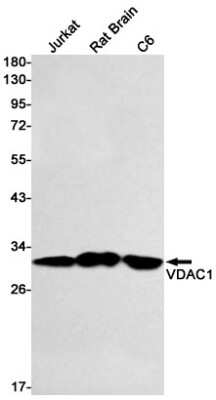 Western Blot: VDAC1 Antibody (S05-7F2) [NBP3-14982]