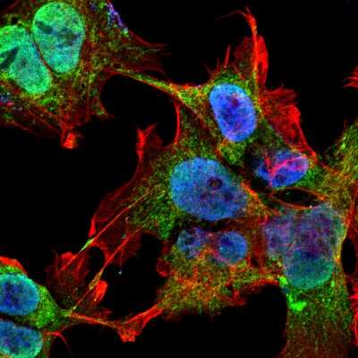 Immunocytochemistry/ Immunofluorescence: VDAC1 Antibody (S152B-23) [NBP2-42187]