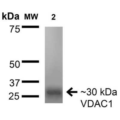 Western Blot: VDAC1 Antibody (S152B-23) [NBP2-42187]