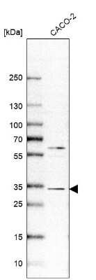 Western Blot: VDAC1 Antibody [NBP2-38163]