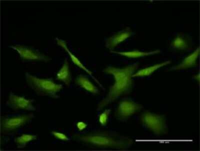 Immunocytochemistry/ Immunofluorescence: VDAC2 Antibody (3D2) [H00007417-M01]