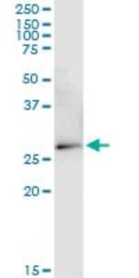 Western Blot: VDAC2 Antibody (3D2) [H00007417-M01]