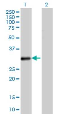 Western Blot: VDAC2 Antibody (3D2) [H00007417-M01]