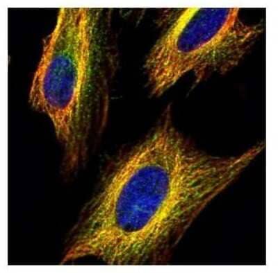 Immunocytochemistry/ Immunofluorescence: VDAC2 Antibody [NBP2-20849]