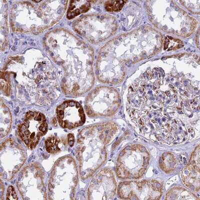 Immunohistochemistry-Paraffin: VDAC2 Antibody [NBP1-89477]