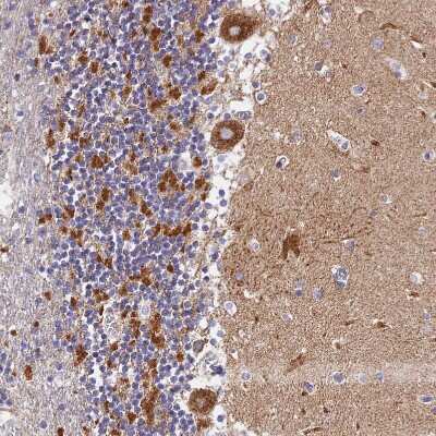 Immunohistochemistry-Paraffin: VDAC2 Antibody [NBP1-89477]