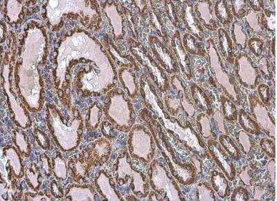 Immunohistochemistry-Paraffin: VDAC2 Antibody [NBP2-20849]