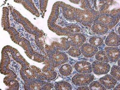 Immunohistochemistry-Paraffin: VDAC2 Antibody [NBP2-20849]