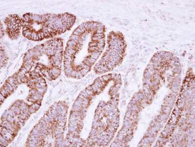 Immunohistochemistry-Paraffin: VDAC2 Antibody [NBP2-20850]